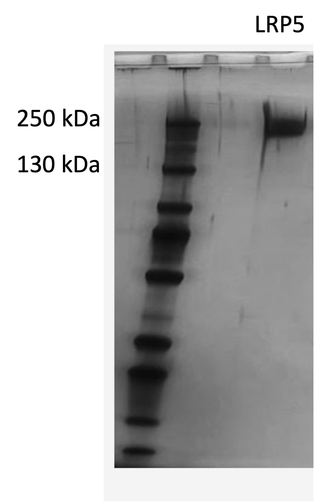 Recombinant Mouse LRP-5 Protein 7344-LR