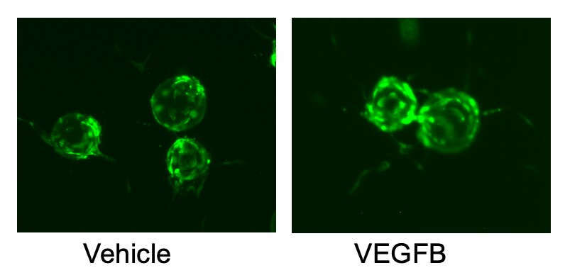 Recombinant Human VEGF-B 167 Protein, CF 751-VEB