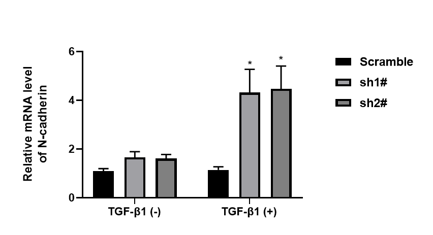 Recombinant Mouse TGF-beta 1 Protein 7666-MB