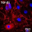 Recombinant Human TGF-beta 1 (Human Cell-expressed) Protein 7754-BH