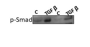 Recombinant Human TGF-beta 1 (Human Cell-expressed) Protein 7754-BH
