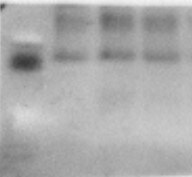 Recombinant Human IL-17E (Human Cell-expressed) Protein 8134-IL