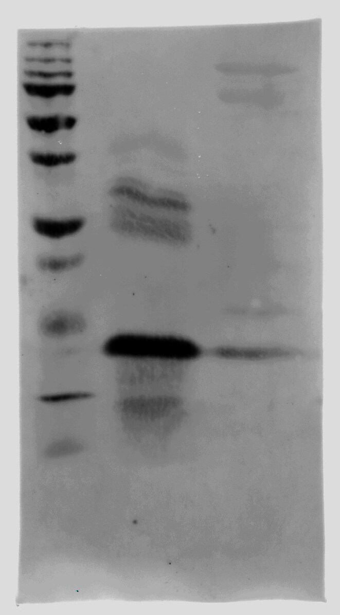Recombinant Human S100A8/S100A9 Heterodimer Protein, CF 8226-S8