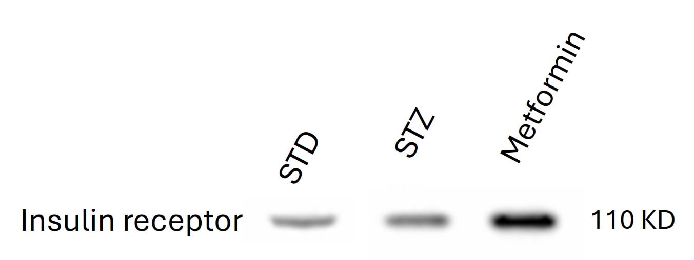Recombinant Human Insulin R/CD220 (aa 28-956) Protein, CF 8974-IR