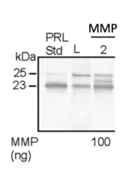 Recombinant Human MMP-2 Protein, CF 902-MP