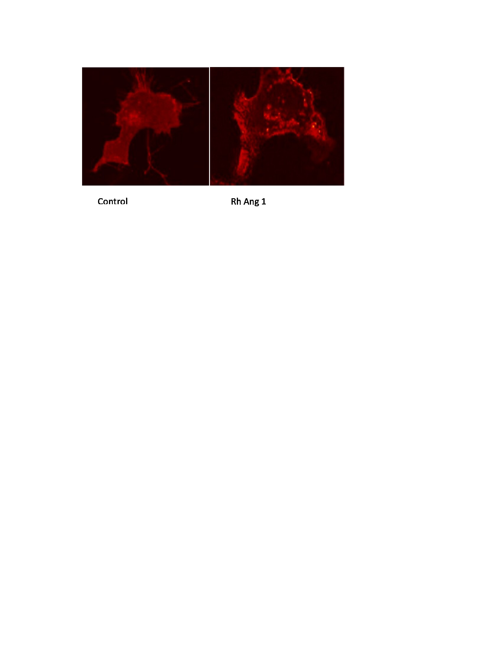 Recombinant Human Angiopoietin-1 Protein 923-AN