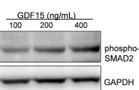 Recombinant Human GDF-15 (CHO-expressed) Protein 957-GD
