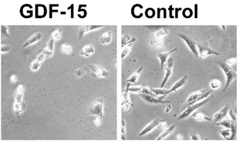 Recombinant Human GDF-15 (CHO-expressed) Protein 957-GD