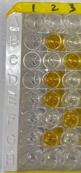 Recombinant Human Neogenin Fc Chimera Protein, CF 9699-NE
