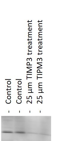 Recombinant Human TIMP-3 Protein, CF 973-TM