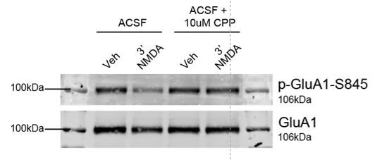 NMDA 0114