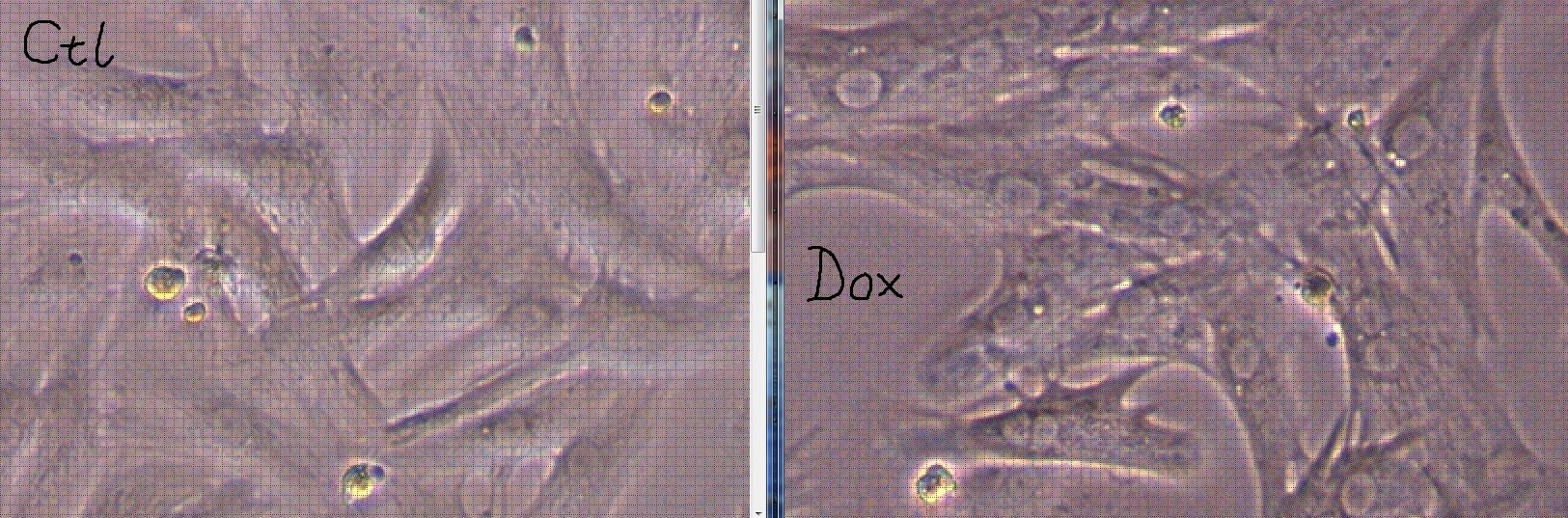 Doxorubicin hydrochloride 2252