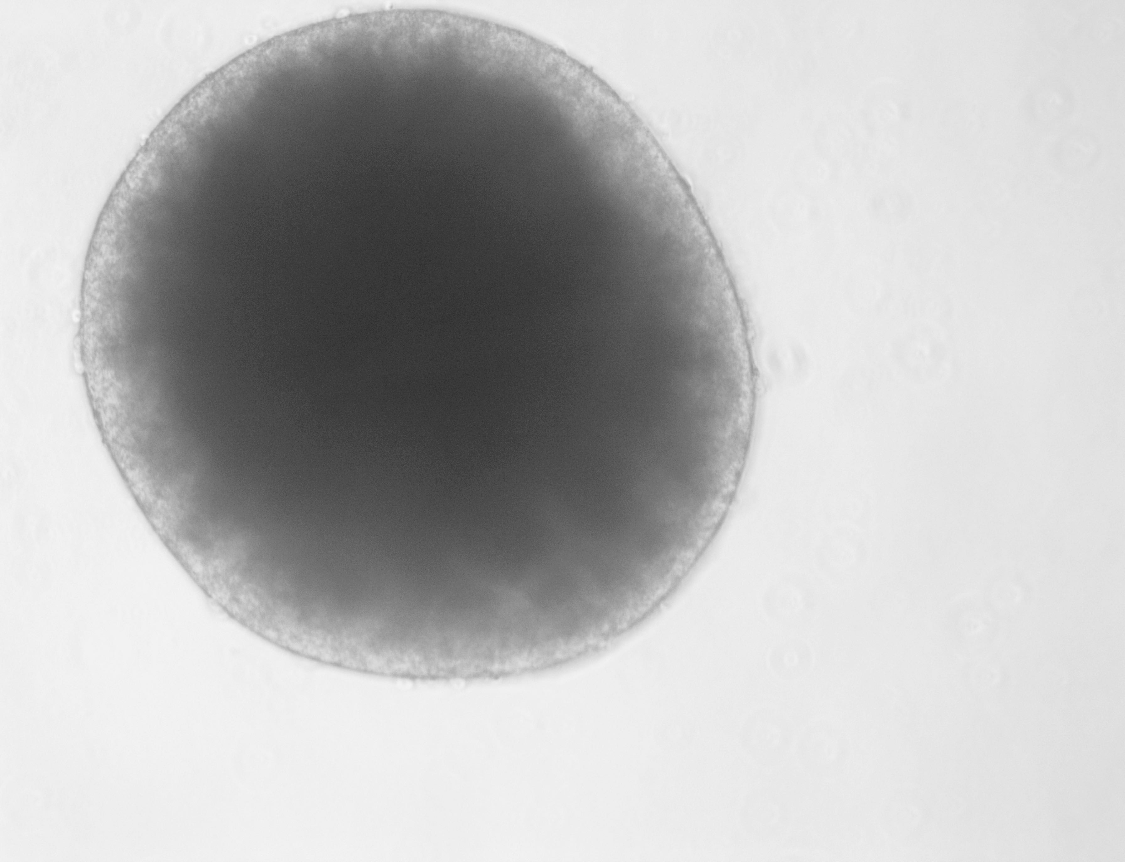 SB 431542 1614