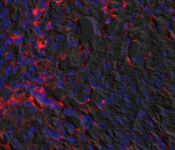TGF‑ beta  Pan Specific Antibody AB-100-NA