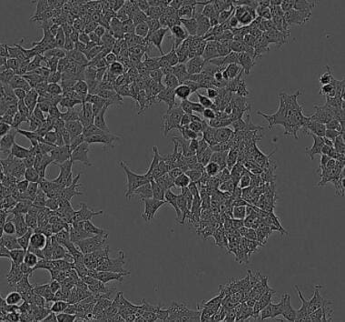 Human IL‑1 beta /IL‑1F2 Antibody AB-201-NA