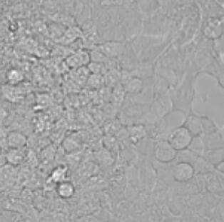 Human CCL5/RANTES Antibody AB-278-NA