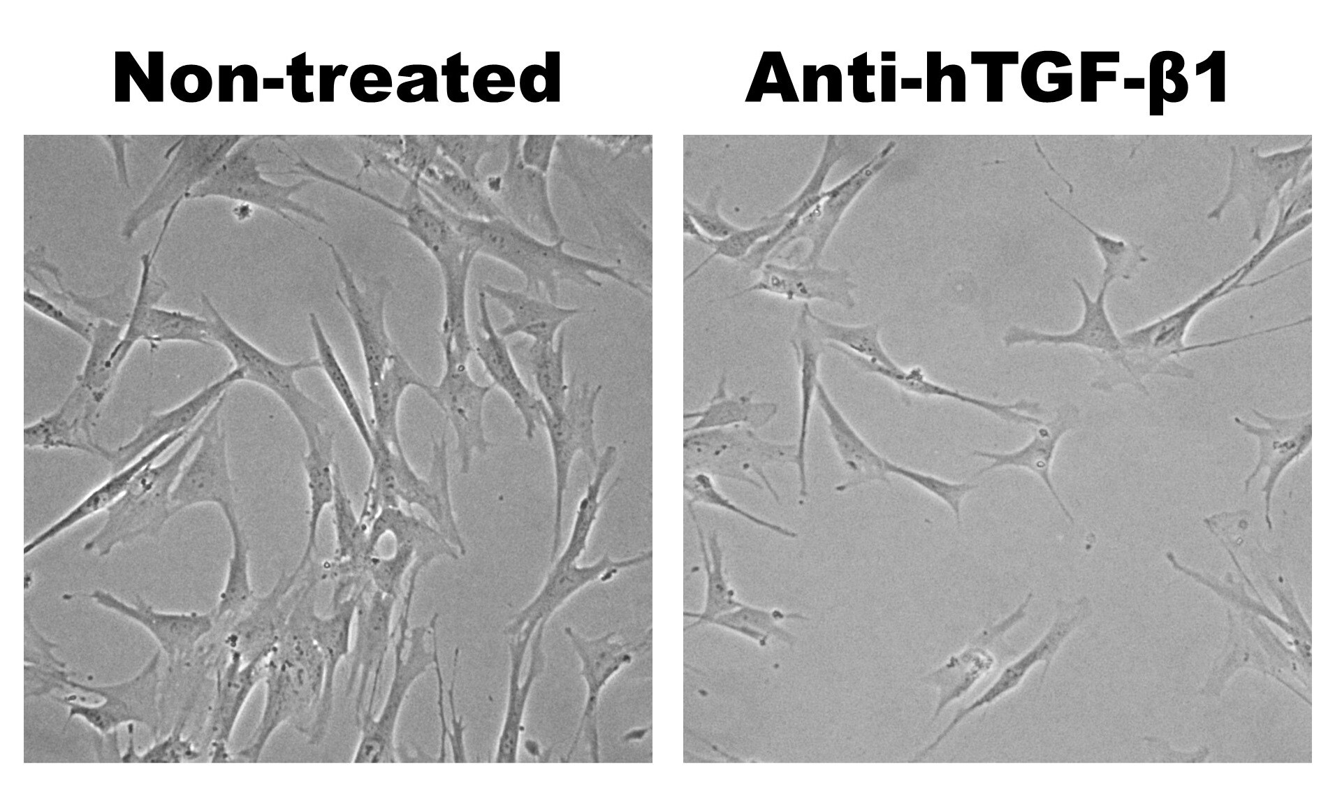TGF‑ beta 1/1.2 Antibody AF-101-NA