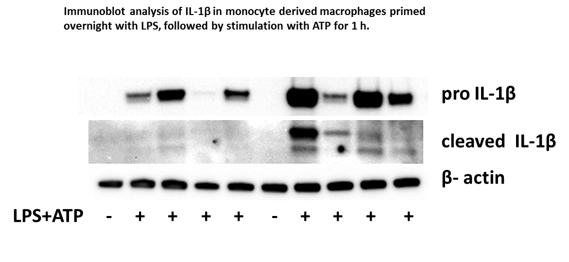 Human IL‑1 beta /IL‑1F2 Antibody AF-201-NA