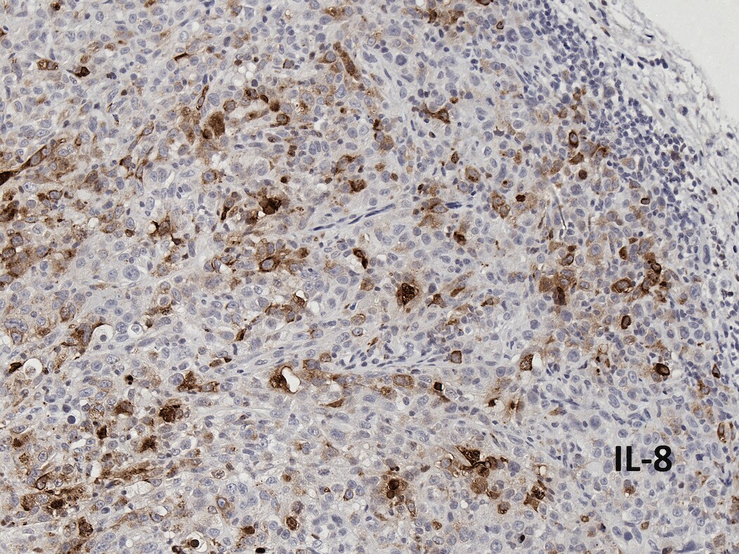 Human IL-8/CXCL8 Antibody AF-208-NA