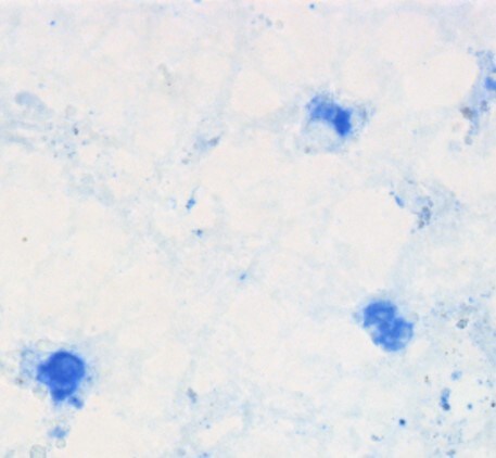 Human TNF‑ alpha  Antibody AF-210-NA