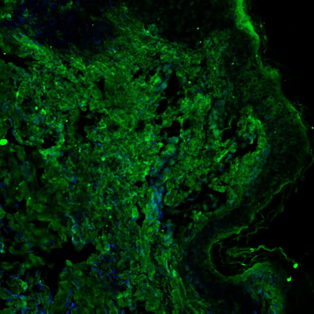 Human G‑CSF Antibody AF-214-NA
