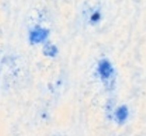 Human GM‑CSF Antibody AF-215-NA