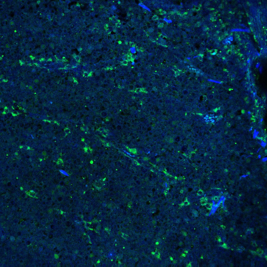 Human GM‑CSF Antibody AF-215-NA