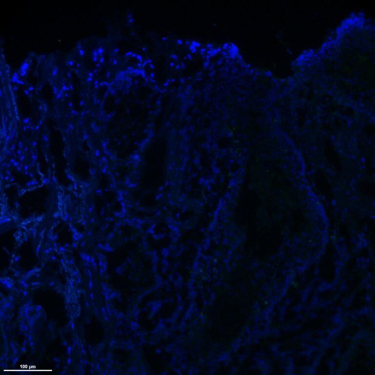 Human IL‑10 Antibody AF-217-NA