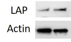 Human LAP (TGF-beta 1) Antibody AF-246-NA