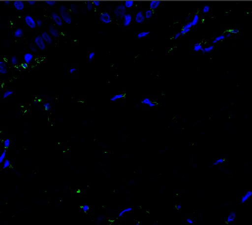 Human LIF Antibody AF-250-NA