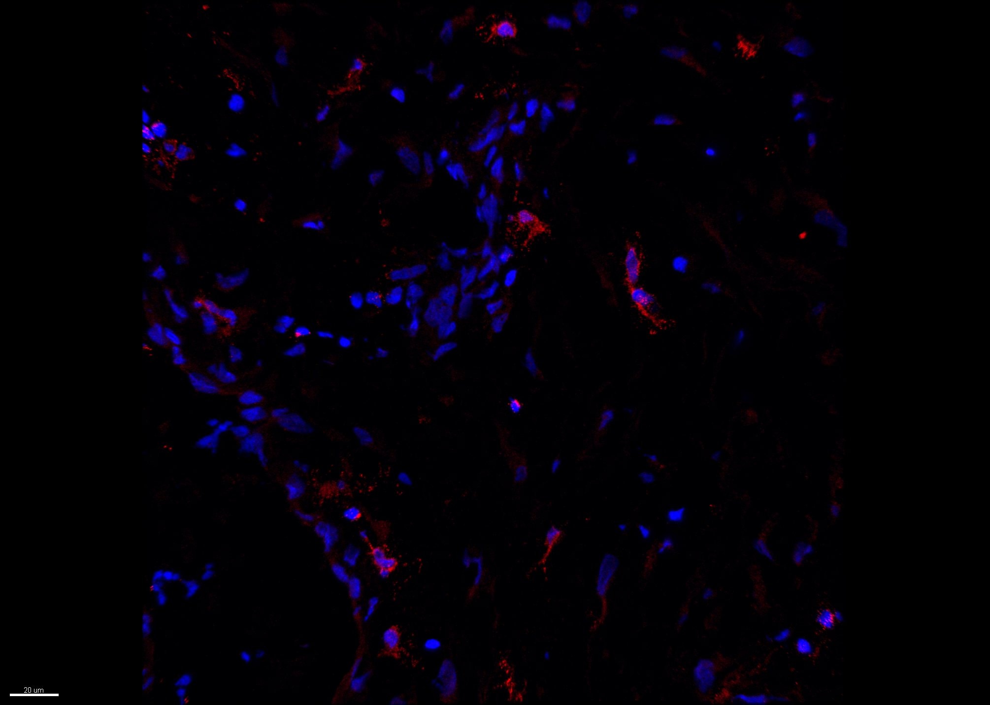 Human CCL5/RANTES Antibody AF-278-NA