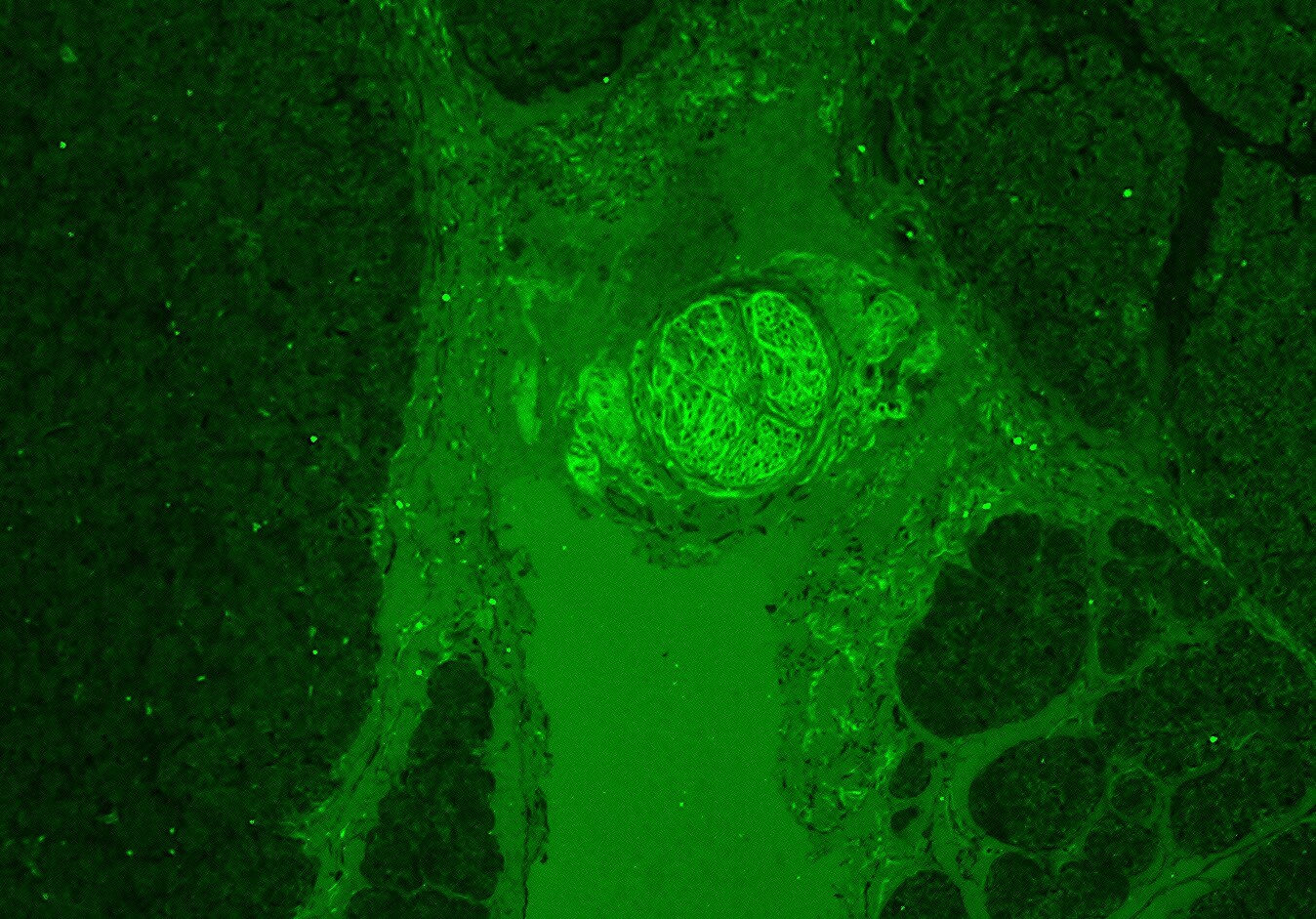 Human IGF-I/IGF-1 Antibody AF-291-NA