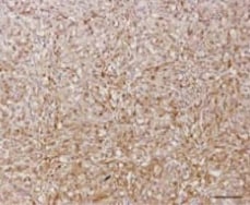 Human HGF Antibody AF-294-NA