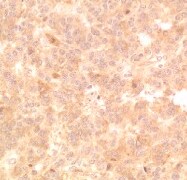Human/Mouse IGF-I R/IGF1R Antibody AF-305-NA