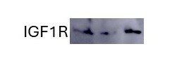 Human/Mouse IGF-I R/IGF1R Antibody AF-305-NA
