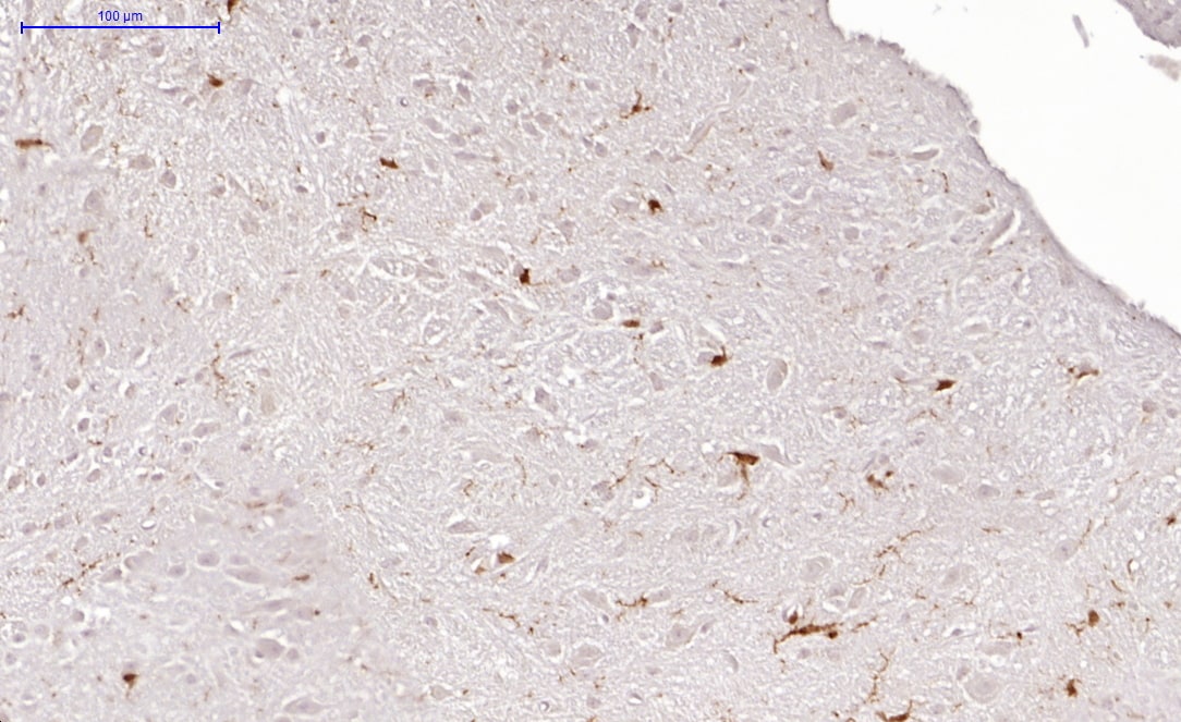Human PDGF R alpha  Antibody AF-307-NA