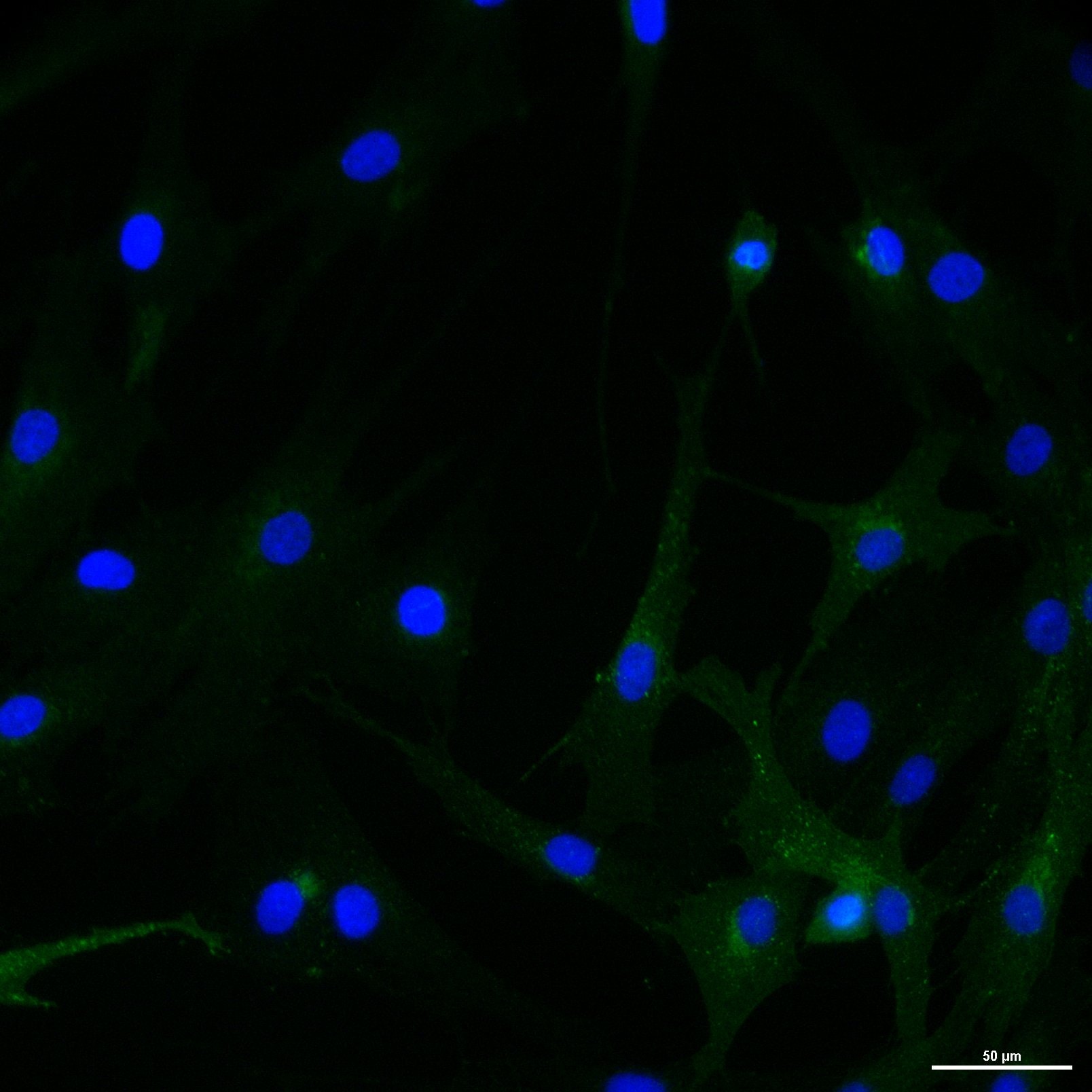 Human PDGF R alpha  Antibody AF-307-NA