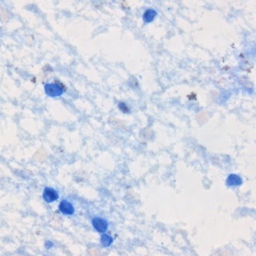 Human IL‑17/IL‑17A Antibody AF-317-NA