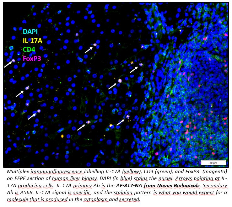 Human IL‑17/IL‑17A Antibody AF-317-NA