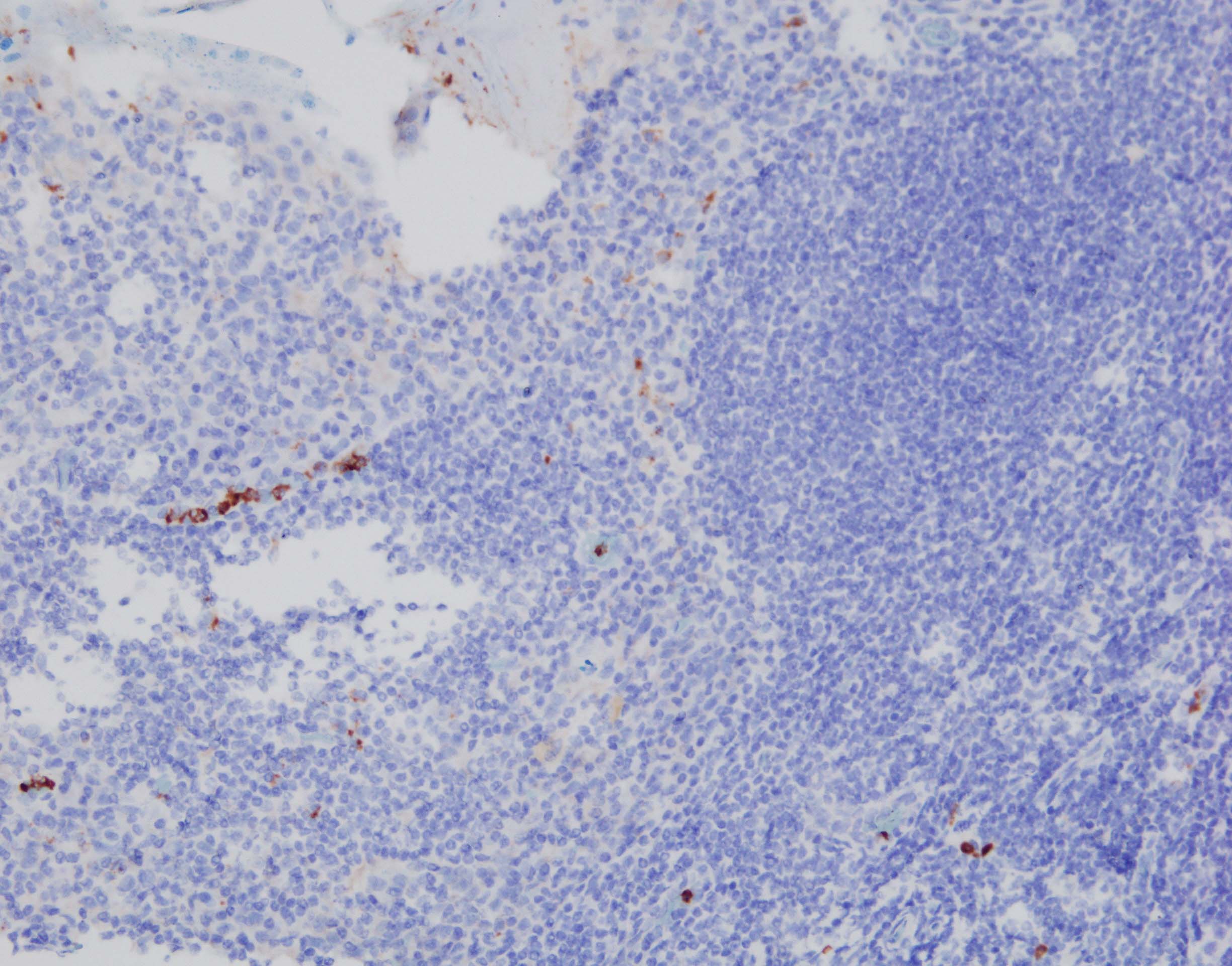 Human IL‑17/IL‑17A Antibody AF-317-NA