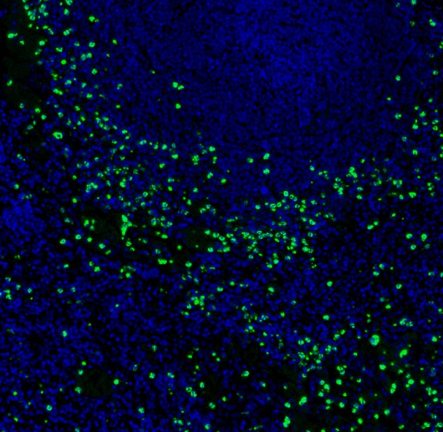Human IL‑17/IL‑17A Antibody AF-317-NA