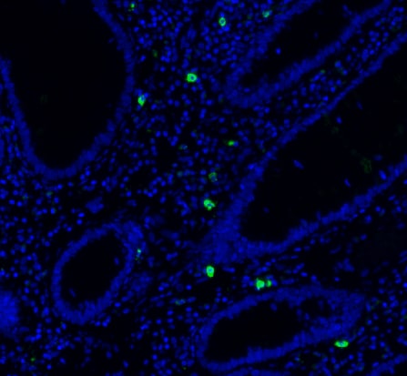 Human IL‑17/IL‑17A Antibody AF-317-NA