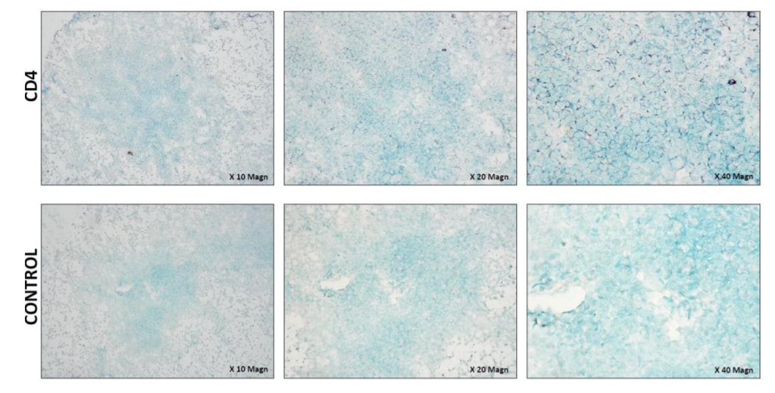 Human CD4 Antibody AF-379-NA