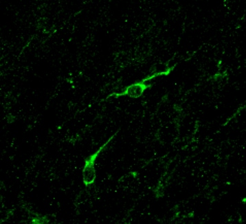Human/Mouse Doublecortin/DCX Antibody AF10025