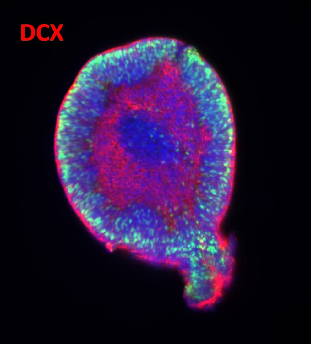Human/Mouse Doublecortin/DCX Antibody AF10025