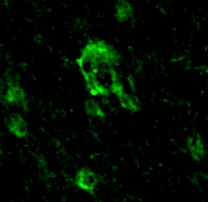 Human/Mouse Doublecortin/DCX Antibody AF10025
