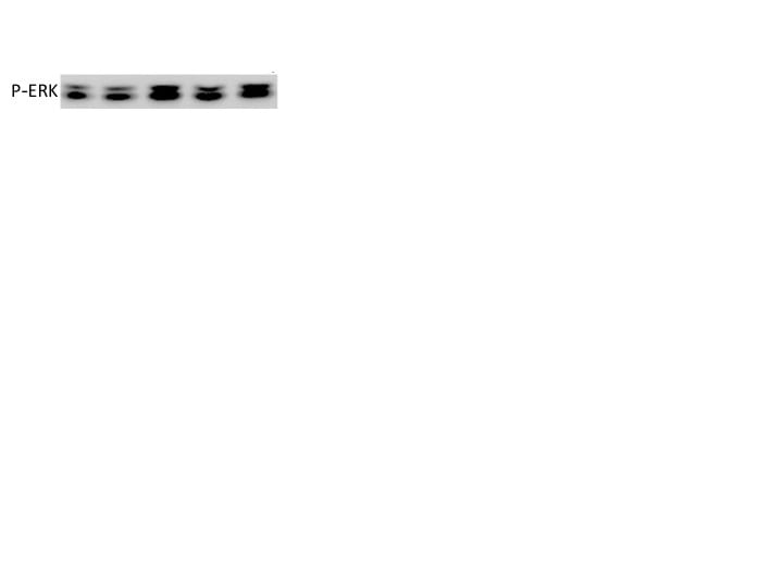 Human/Mouse/Rat Phospho-ERK1(T202/Y204)/ERK2 (T185/Y187) Antibody AF1018