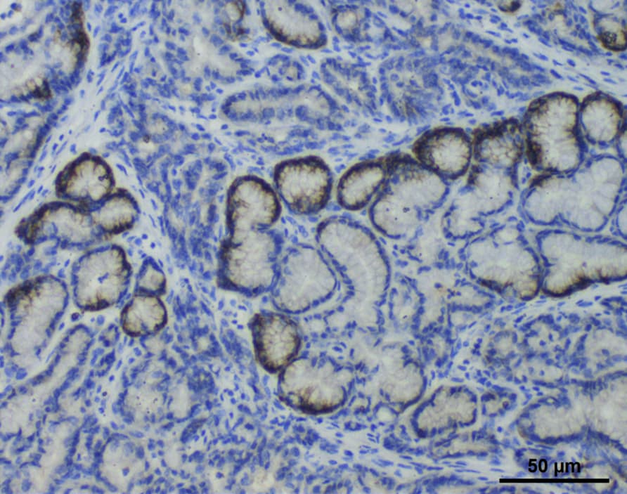 Mouse PD-L1/B7-H1 Antibody AF1019