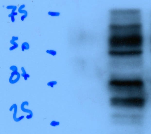 Mouse PD-L1/B7-H1 Antibody AF1019
