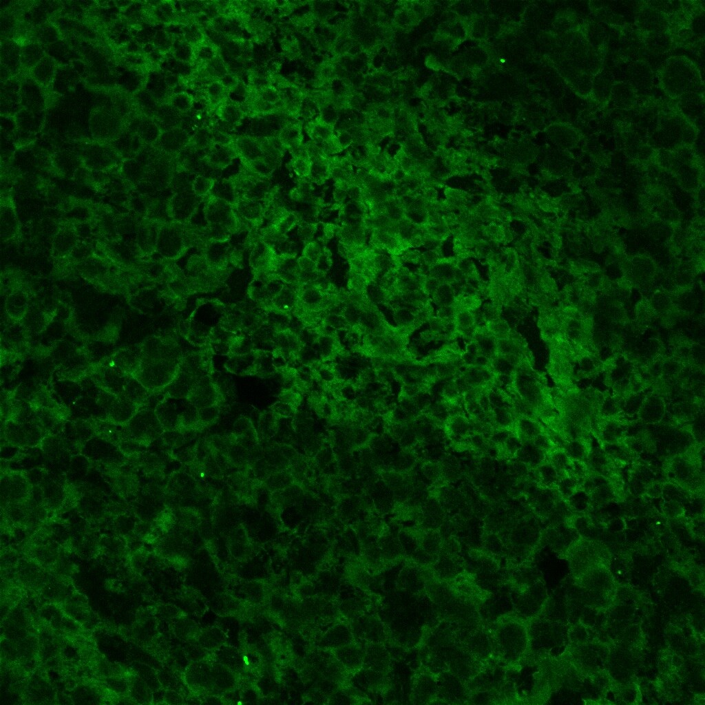 Mouse PD-L1/B7-H1 Antibody AF1019